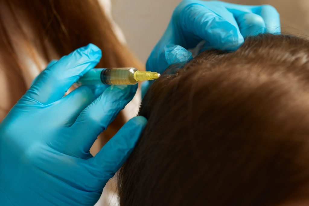 Plasma treatment, plasmolifting or PRP method point the introduction of the patient's own plasma enriched with platelets, in the problem areas of the skin.